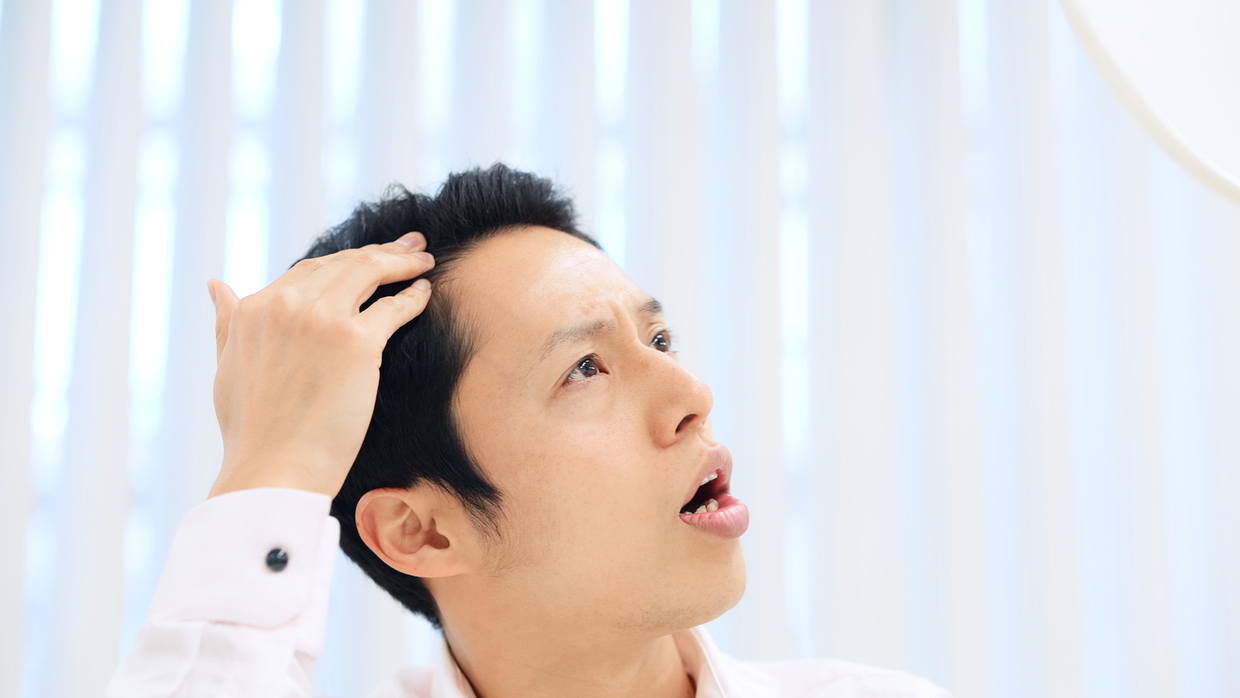 新潟 Aga治療のおすすめクリニック9選 薄毛治療で人気のクリニックを紹介 トラブルブック