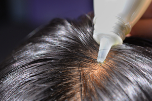 おすすめ市販発毛剤 人気ランキング15選 マピオンニュース