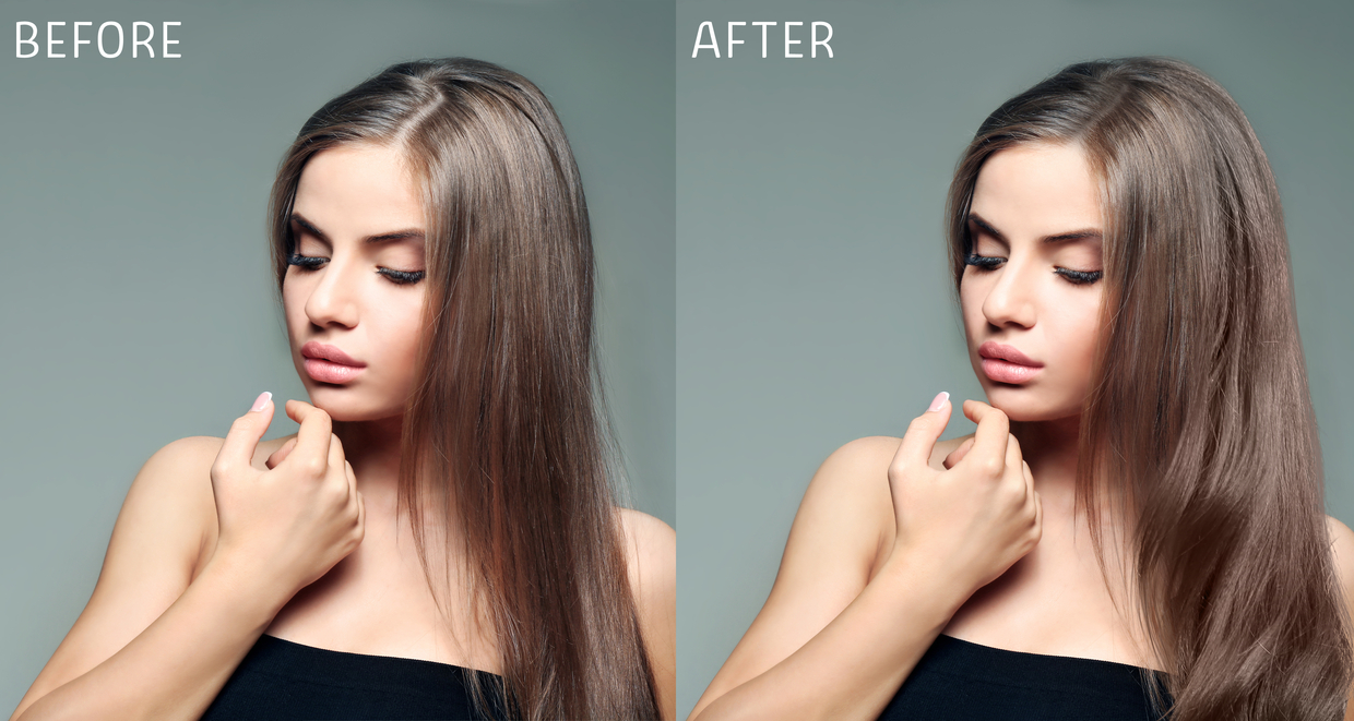 滋賀 女性の薄毛 Faga治療のおすすめクリニック2選 トラブルブック 滋賀 女性の薄毛 Faga治療のおすすめクリニック2選 トラブルブック